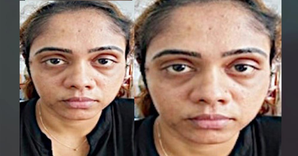 woman who tried to steal 10 lakhs through honeytrap was arrested